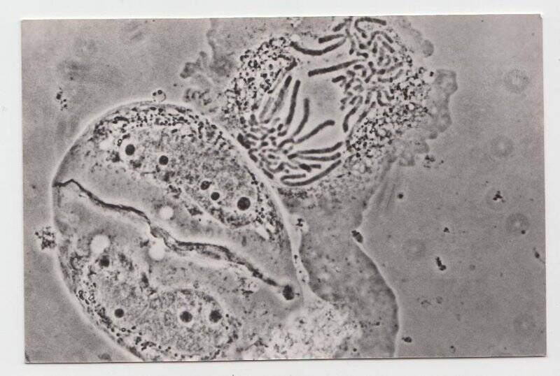 Фотооткрытка. «Микроскапия расхождения хромосом при делении клетки», из комплекта фотооткрыток «Институт биофизики АН СССР»
